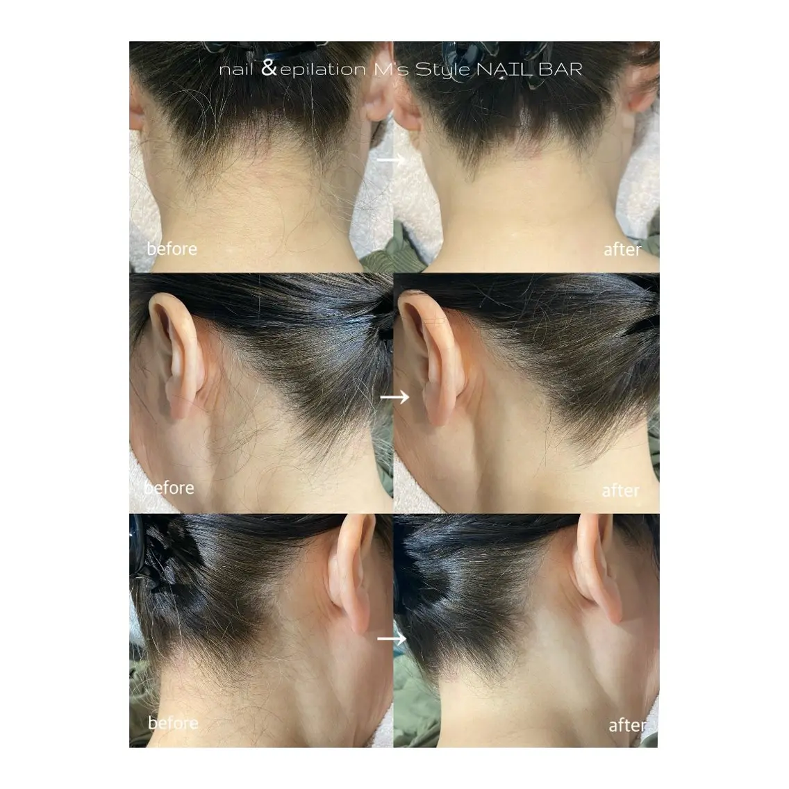 脱毛 M's Style NAIL BARのネイルデザイン