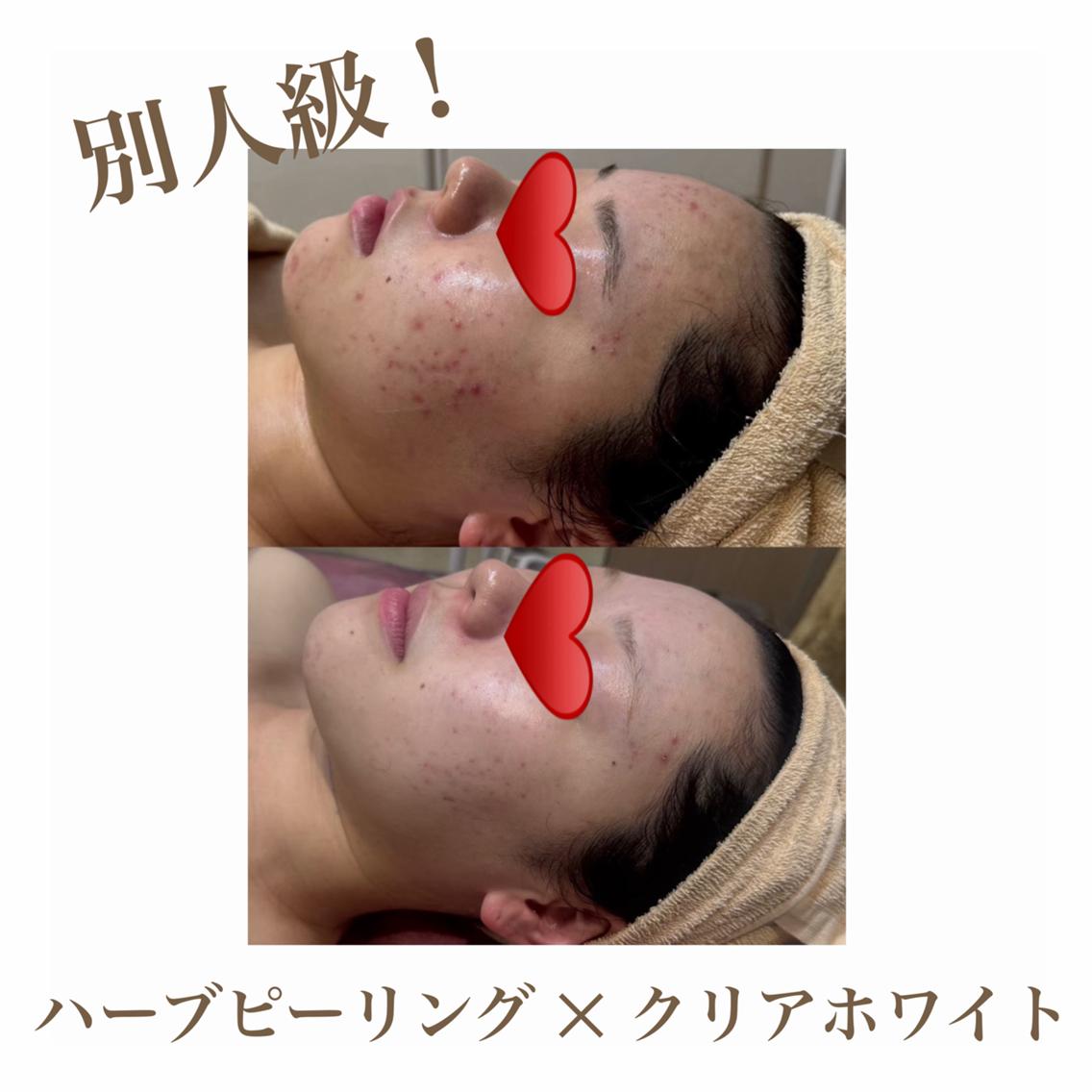 エステ 🫧美肌サロン🫧 レイビスひかる🧡のエステ・リラクイメージ