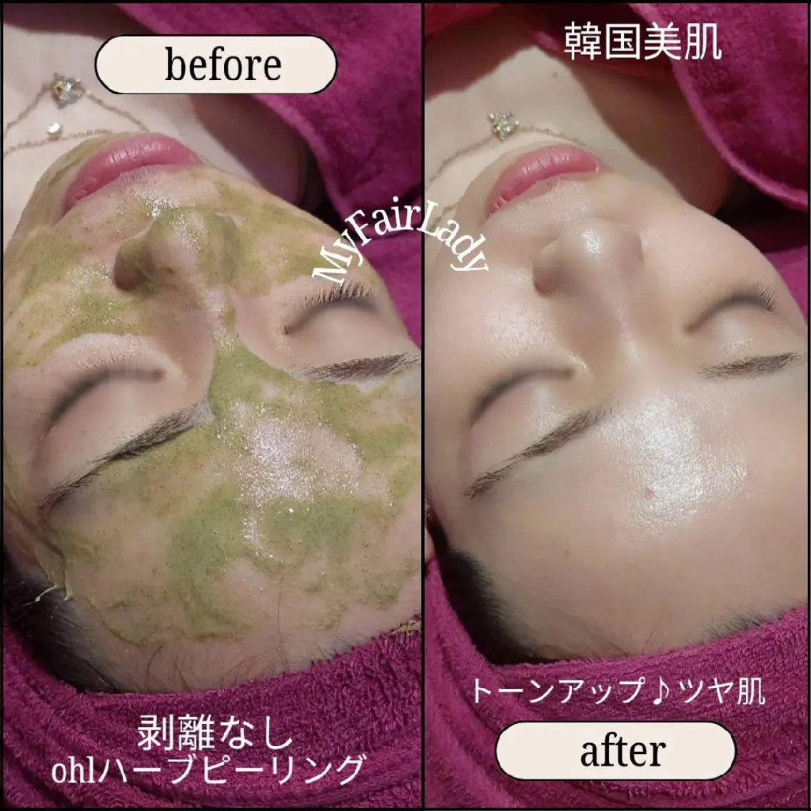 エステ MyFairLady エステmiyuのエステ・リラクイメージ