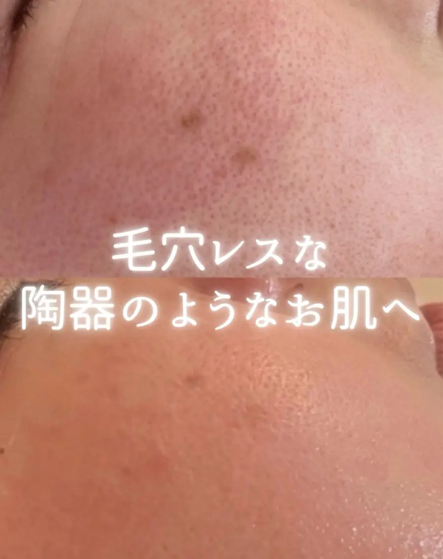リルビー 肌育・肌質改善サロンのその他イメージ