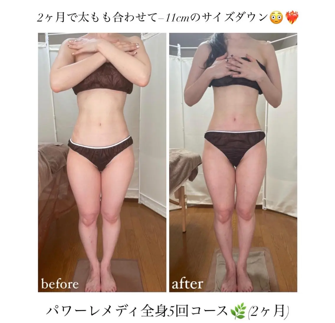 《本気痩せ×疲労改善 》 BILOOPのエステ・リラクイメージ
