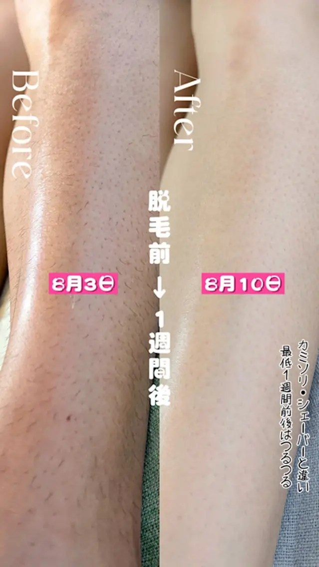 豊橋 |Hitomi シュガーリング専門店のエステ・リラクイメージ