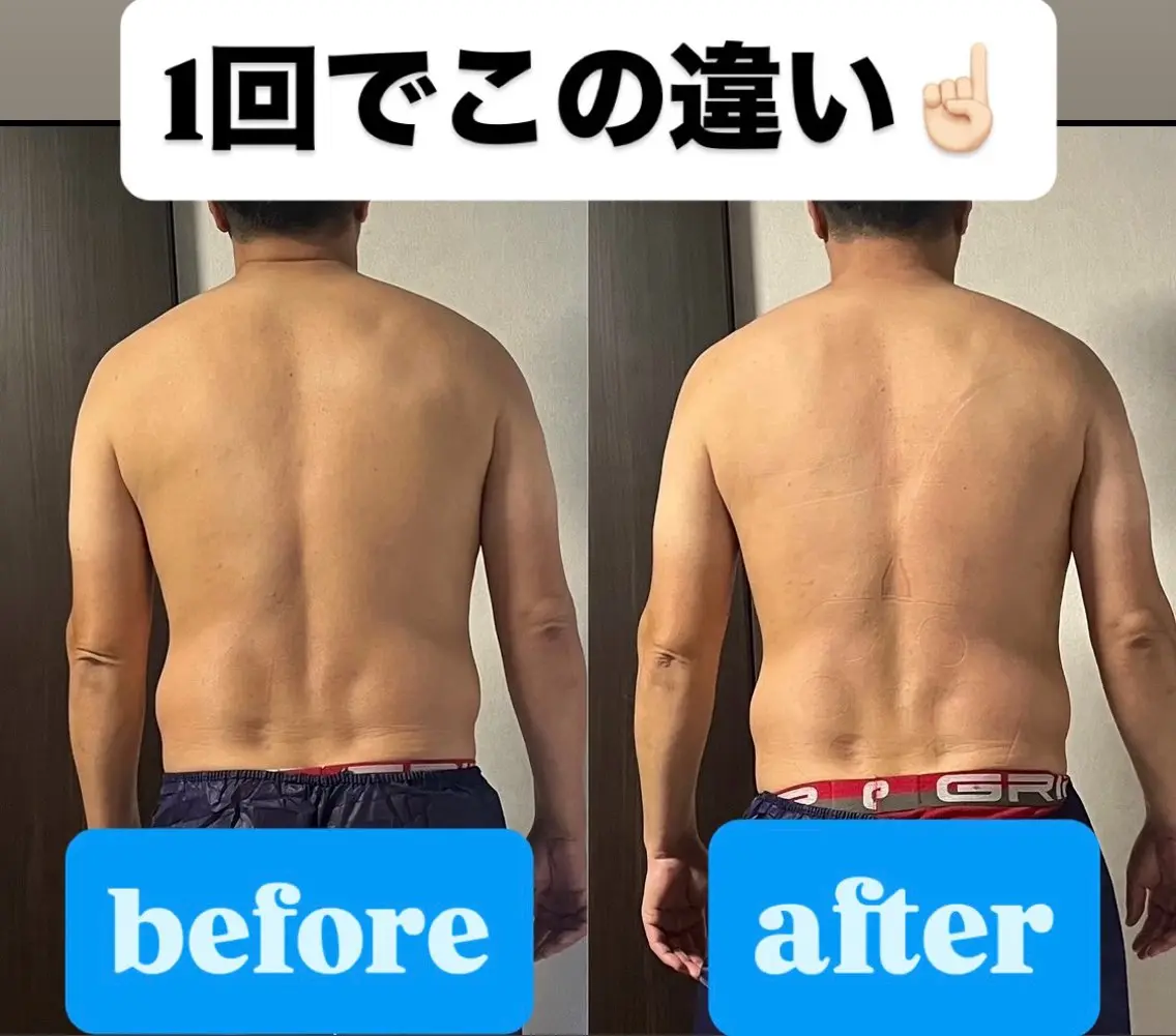 【本気で変えたい方】全身ハイパーナイフ×ウェーブ120分の写真