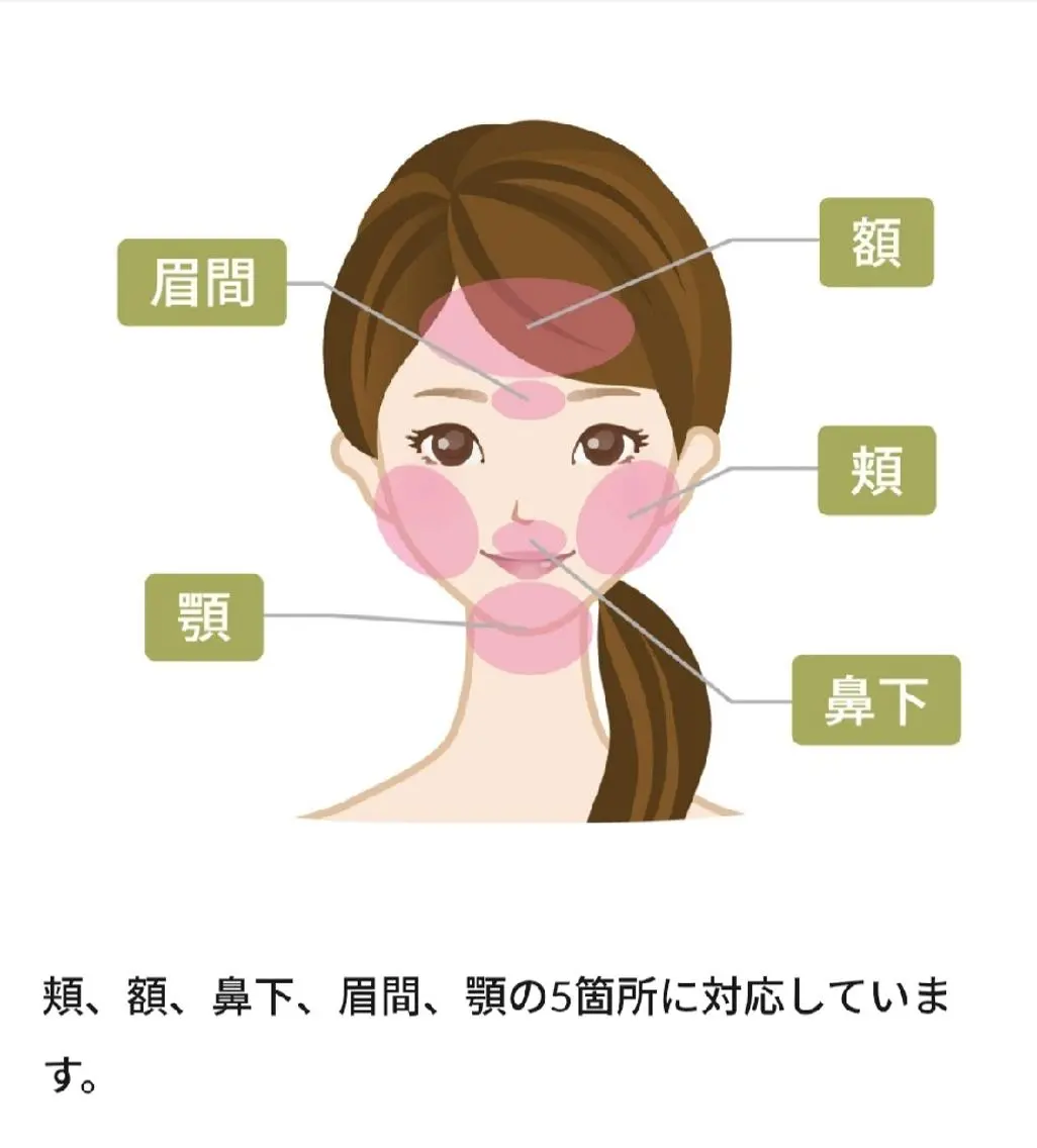 顔まるごと脱毛の写真