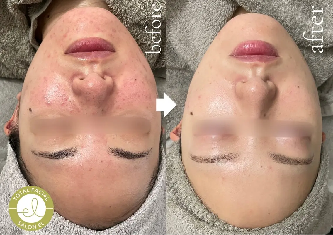 エステ SALON el 歯と肌の専門店のエステ・リラクイメージ