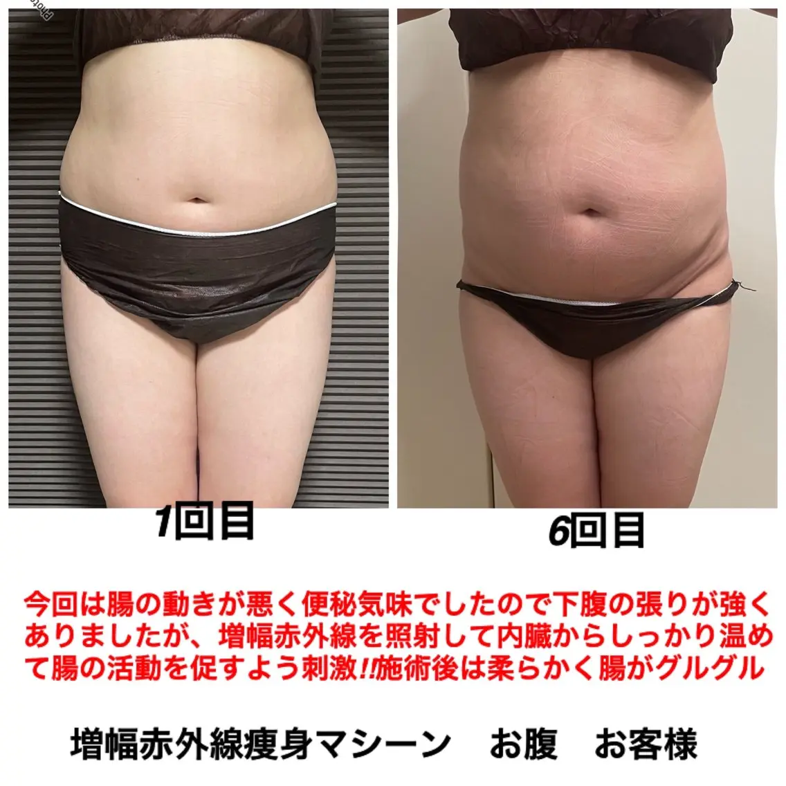 エステ ネイル・エステサロン UILANIのエステ・リラクイメージ
