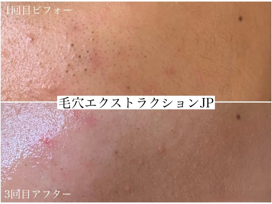 エステ 佐々木 風奈のエステ・リラクイメージ