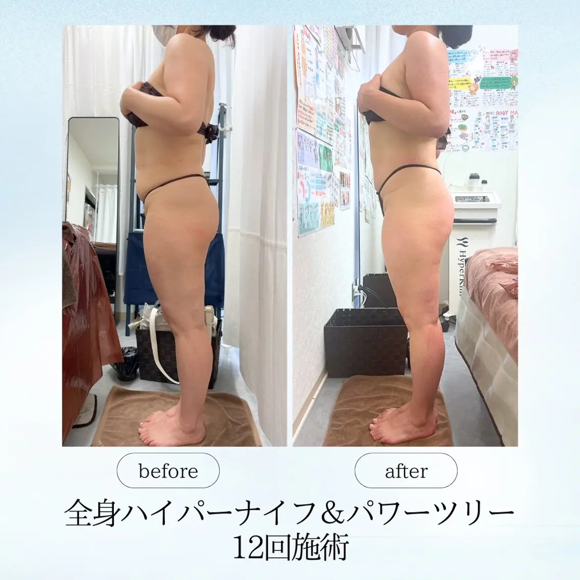 エステ リラク 《痩身、小顔専門店》 エスプレッソのエステ・リラクイメージ