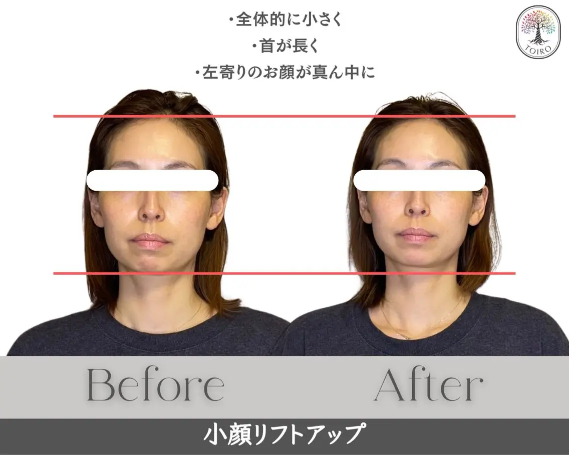 ヘッドスパ・小顔矯正 十色　横浜のエステ・リラクイメージ