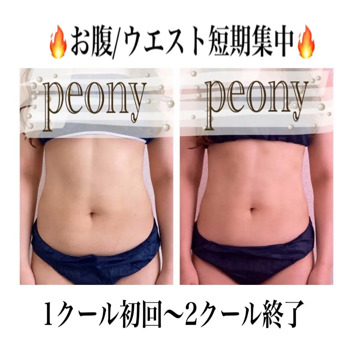 デトックス美容専門 サロンｐｅｏｎｙのエステ・リラクイメージ