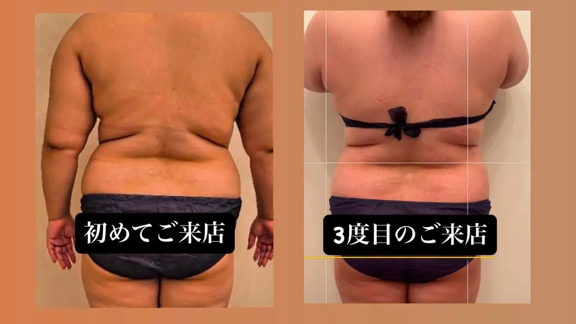 代謝アップ，浮腫み， 体質改善のエステ・リラクイメージ