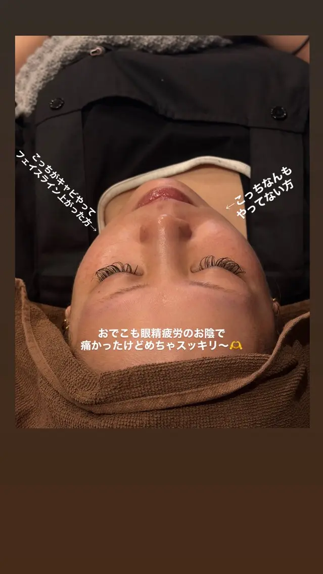 【切らない小顔ケア】キャビテーション、フェイシャル60分の写真