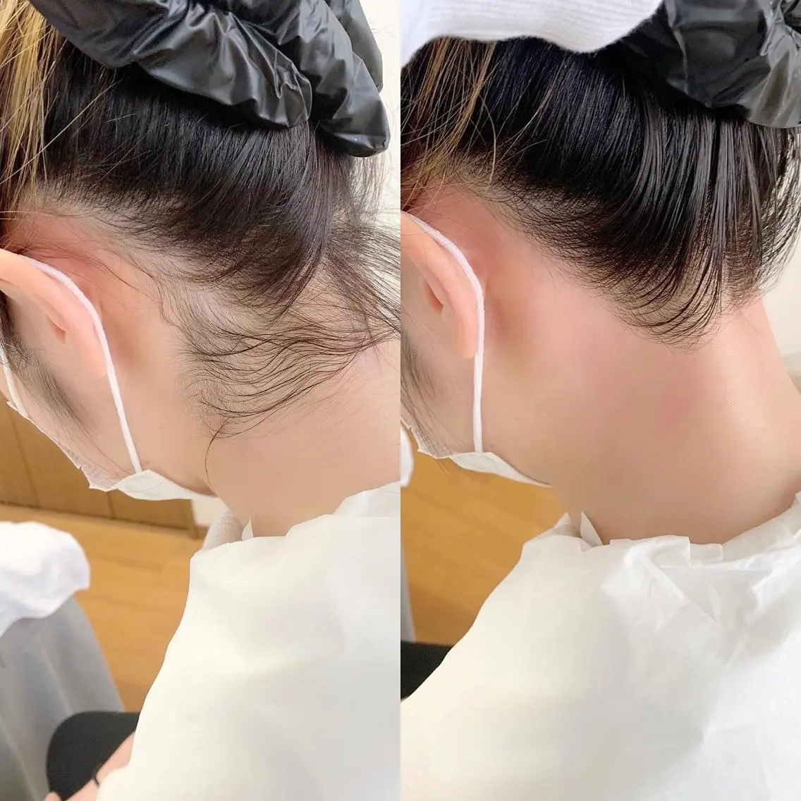 メンズ 脱毛 稲嶺 美華のエステ・リラクイメージ