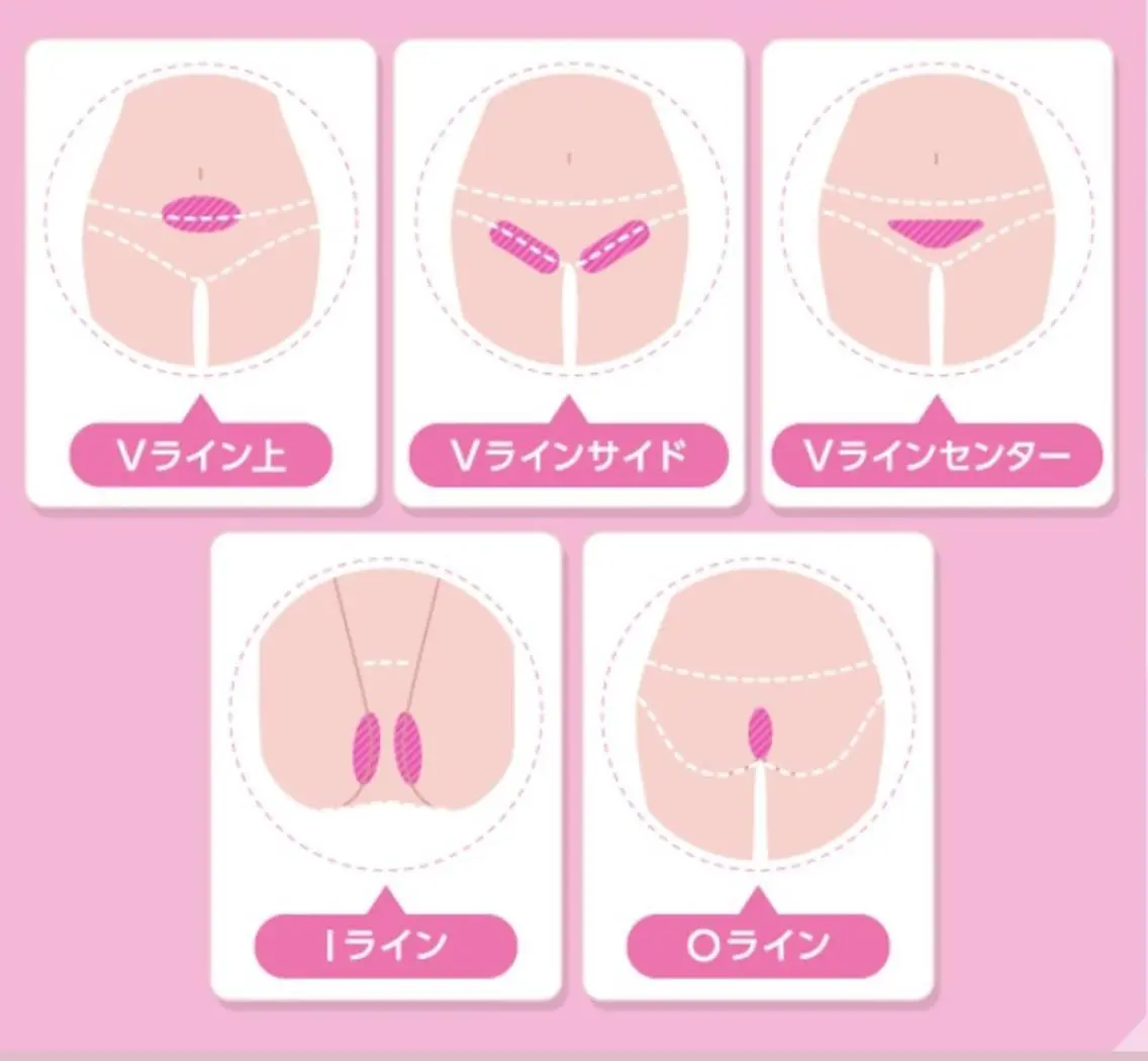 【👼シェービング付VIO脱毛🪽】冷却機能・デザイン自由・美白👌本気で毛をなくしたい方へ💍目指せ自己処理卒業🌟の写真