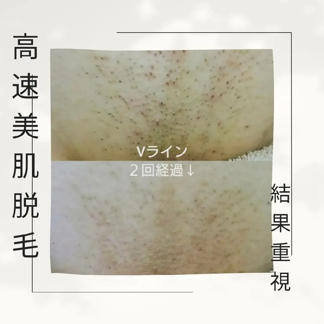 【トータル美容】 Eternityのその他イメージ