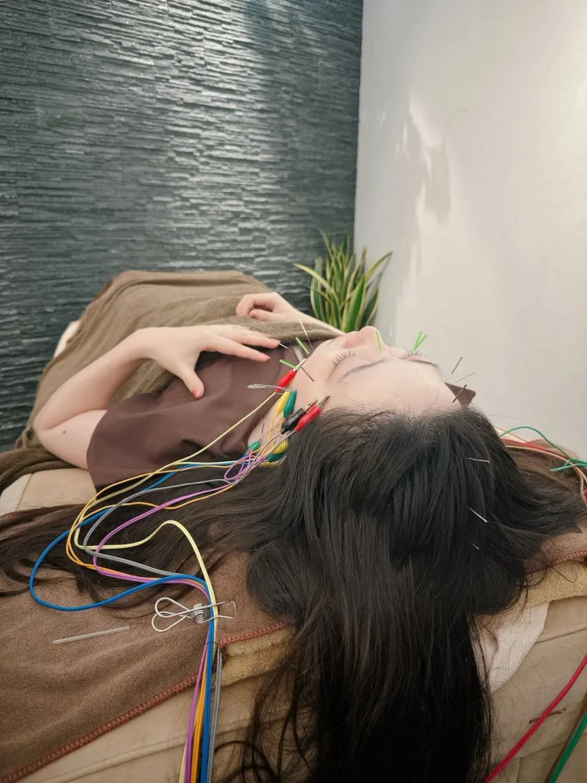その他 小顔矯/美容鍼/鍼灸 BeauJuのその他イメージ