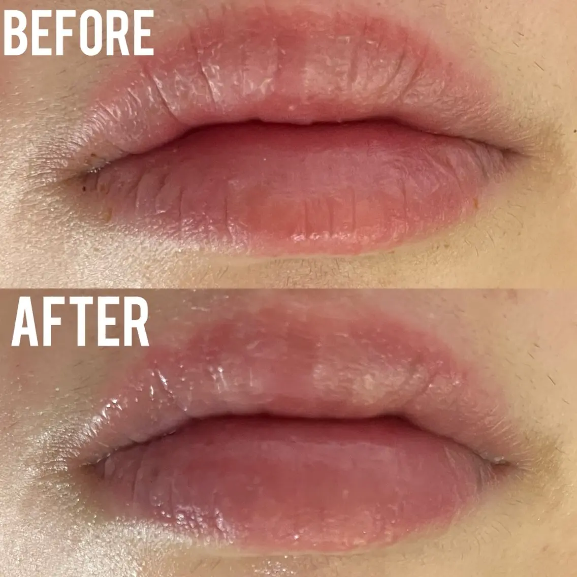 エステ 小顔、毛穴ケア 通い放題エステのエステ・リラクイメージ