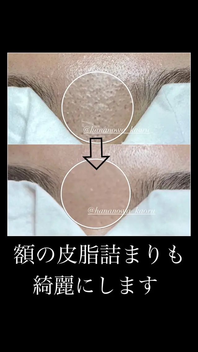毛穴&リンパマッサー ジ専門サロン花のWAのエステ・リラクイメージ