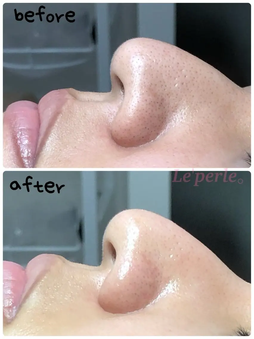 エステ Le'perle｡ Kyokaのエステ・リラクイメージ