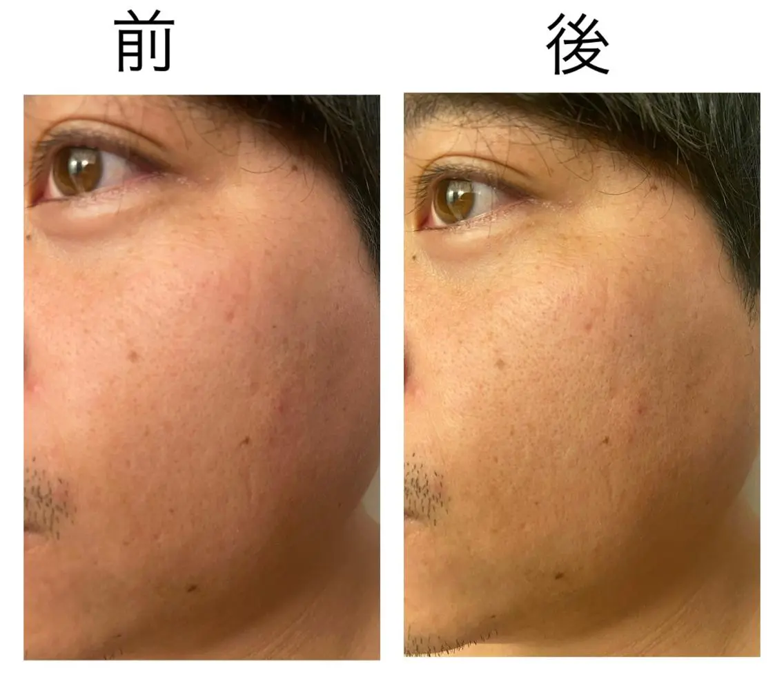 ショート ネイル マツエク・マツパ アイブロウ 小倉 麻由のエステ・リラクイメージ