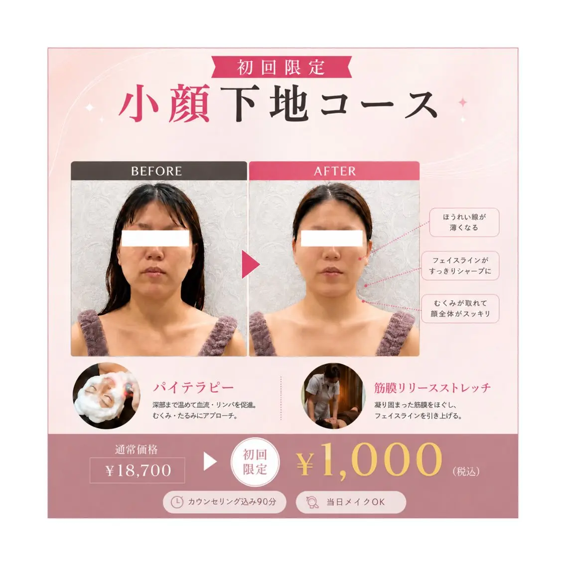 エステ MIRAI小顔 広島駅前店のエステ・リラクイメージ