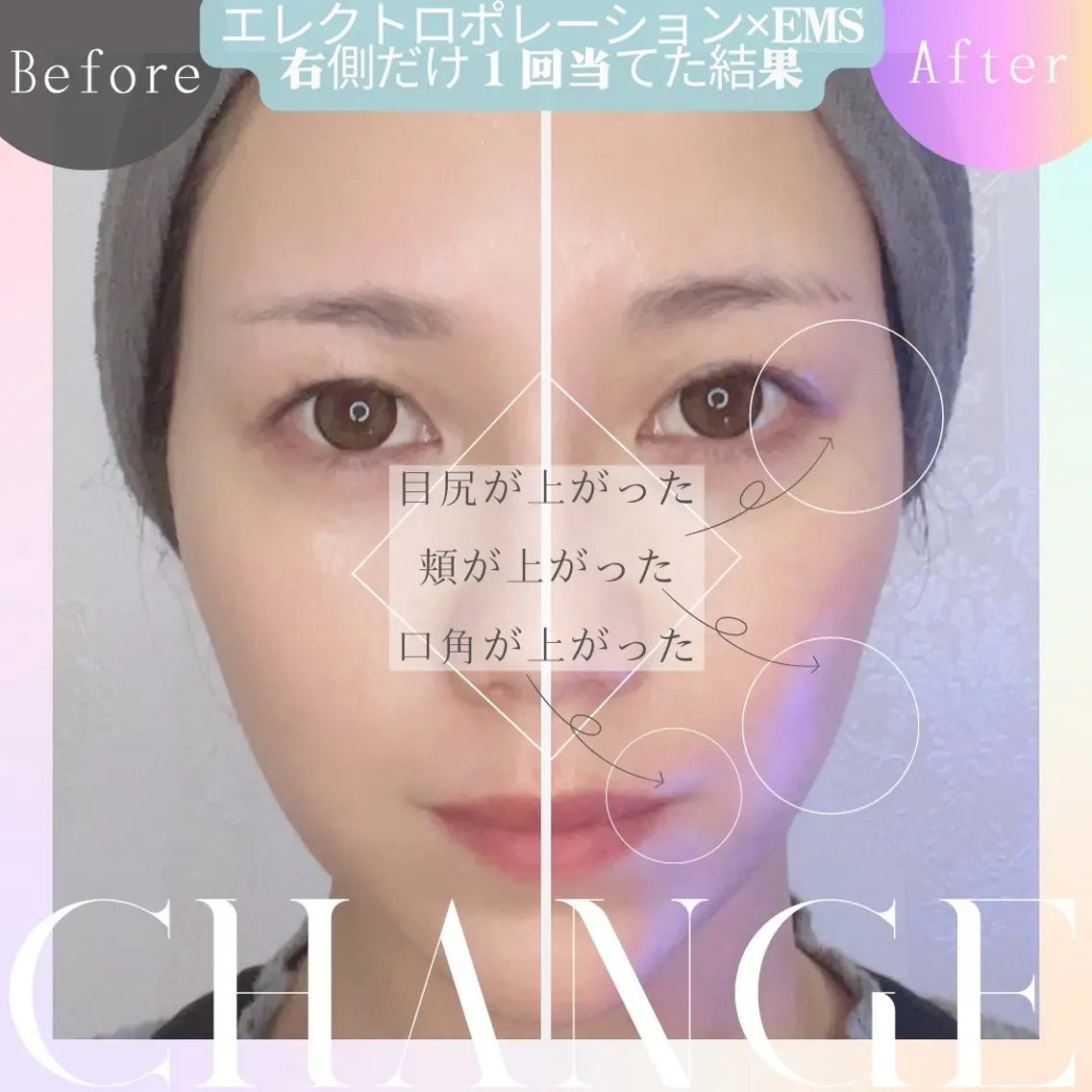 もちぷるリフトアップの写真