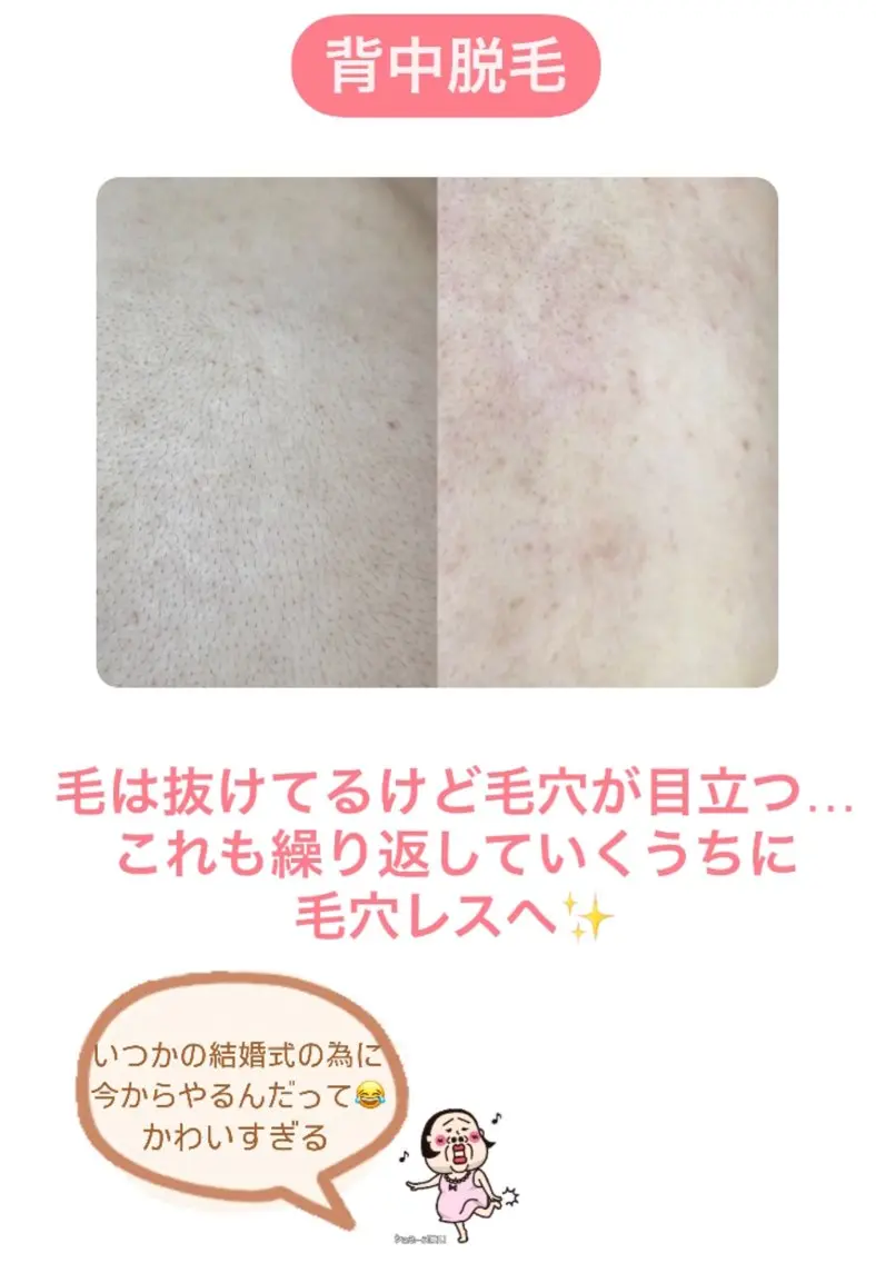 豊橋 ｜Hitomi シュガーリング専門店のエステ・リラクイメージ