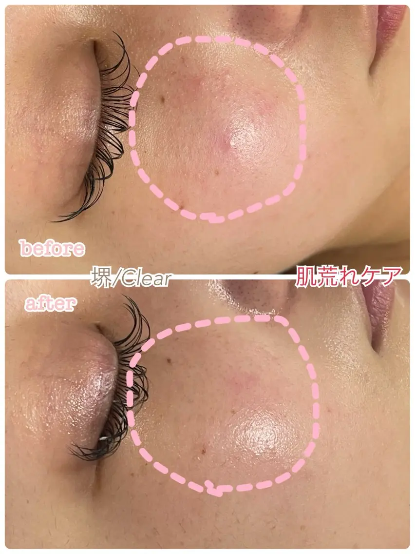 贅沢プライベート サロンClearのエステ・リラクイメージ