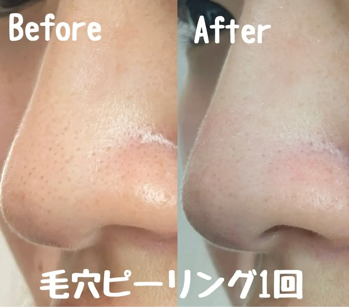 エステ リラク Surien 水脇ゆうのその他イメージ
