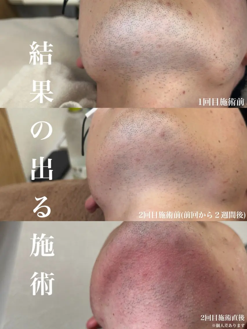 メンズ muumo まりののエステ・リラクイメージ