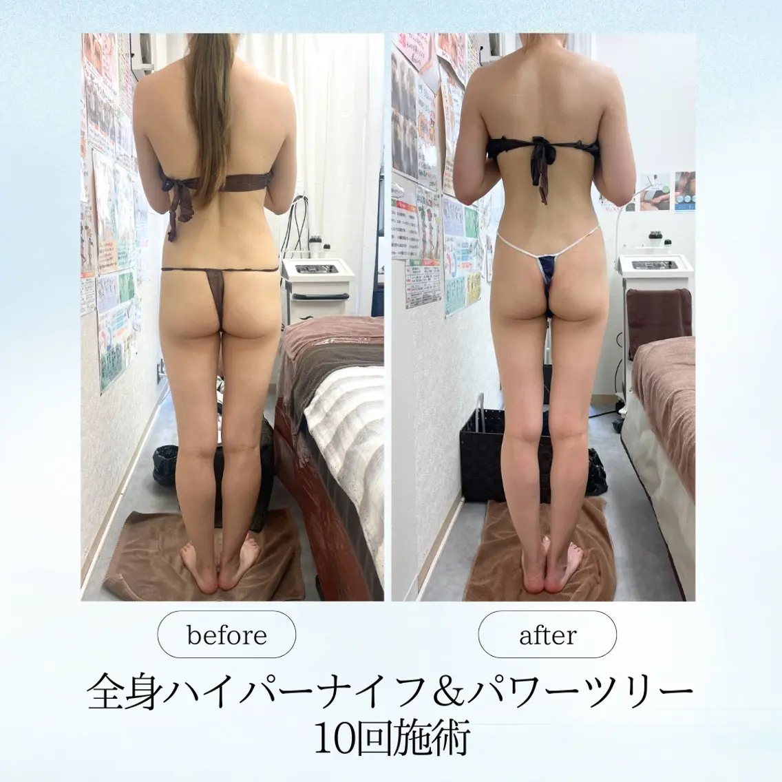エステ リラク 《痩身、小顔専門店》 エスプレッソのエステ・リラクイメージ