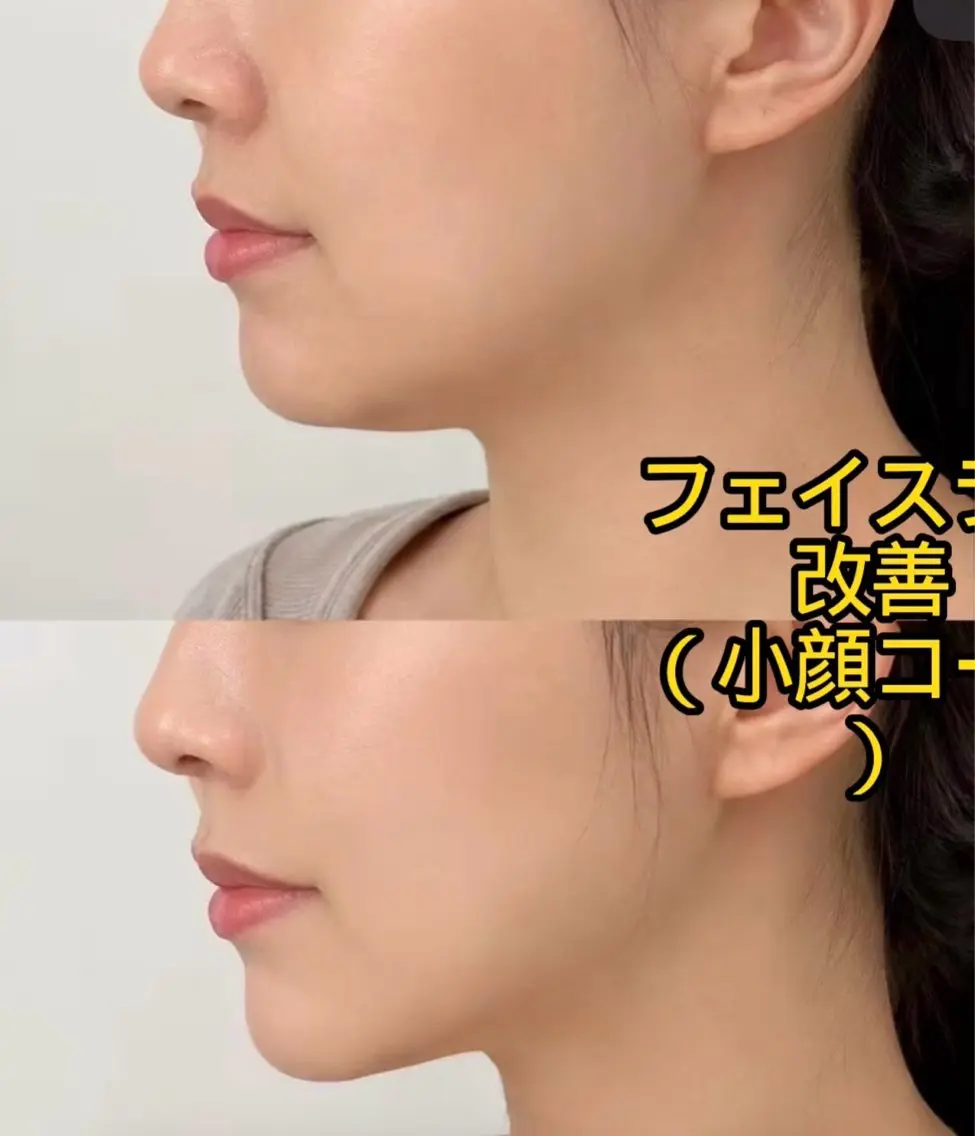 エステ JUNA 健康美サロン渋谷店のエステ・リラクイメージ