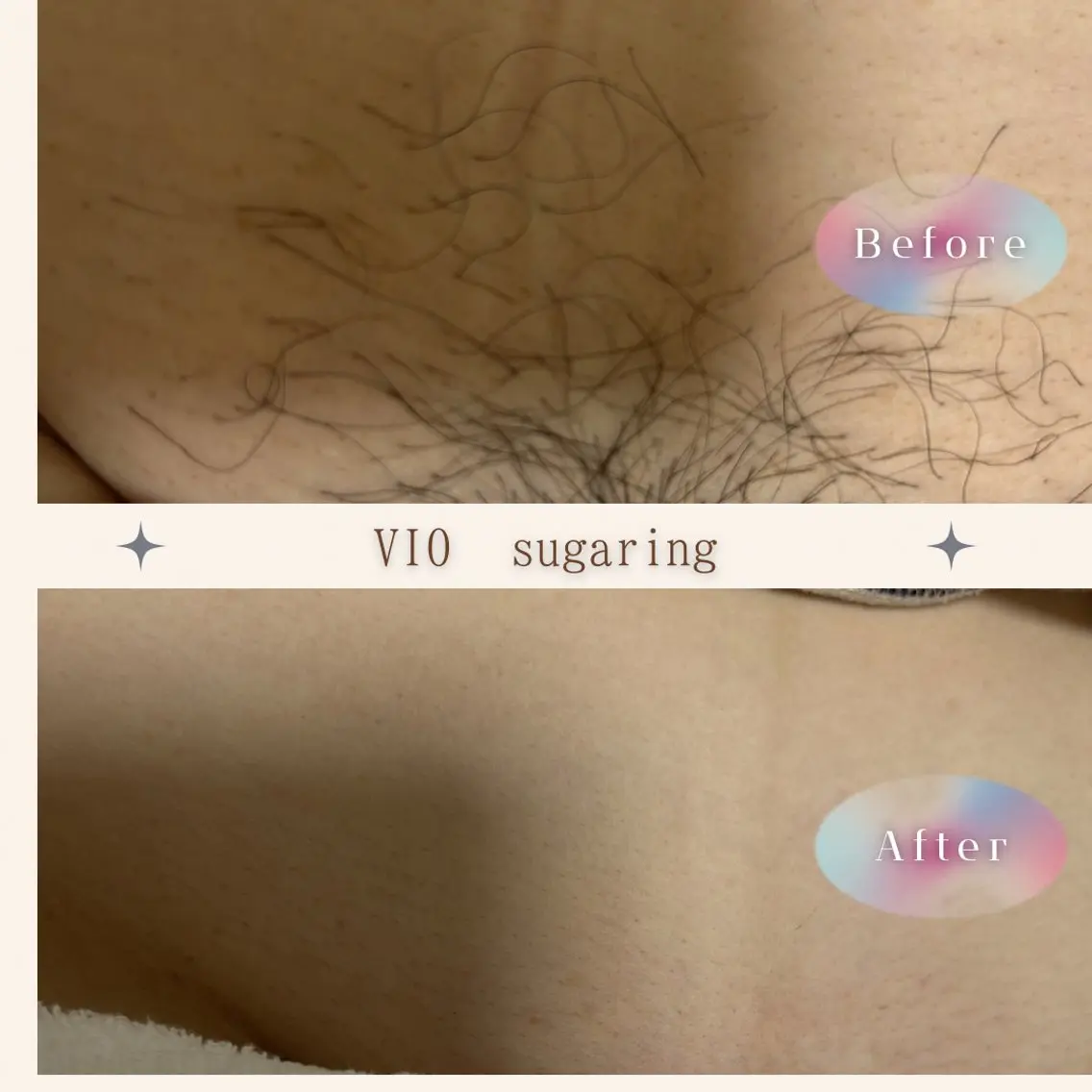 sugaring miiiのエステ・リラクイメージ