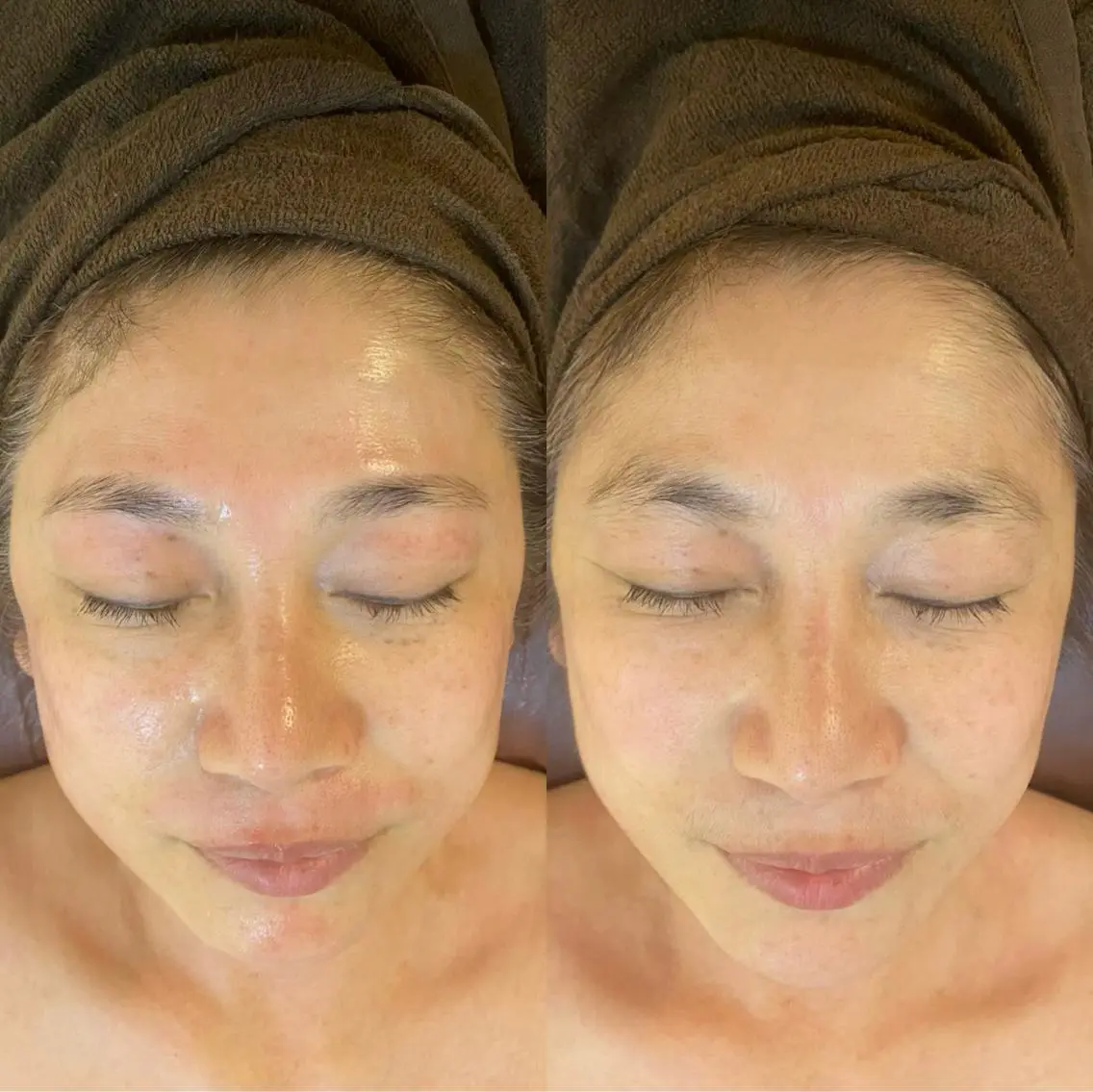 アイブロウ 眉毛ワックス脱毛 脱毛 韓国肌管理サロン BELCIA福岡店のエステ・リラクイメージ
