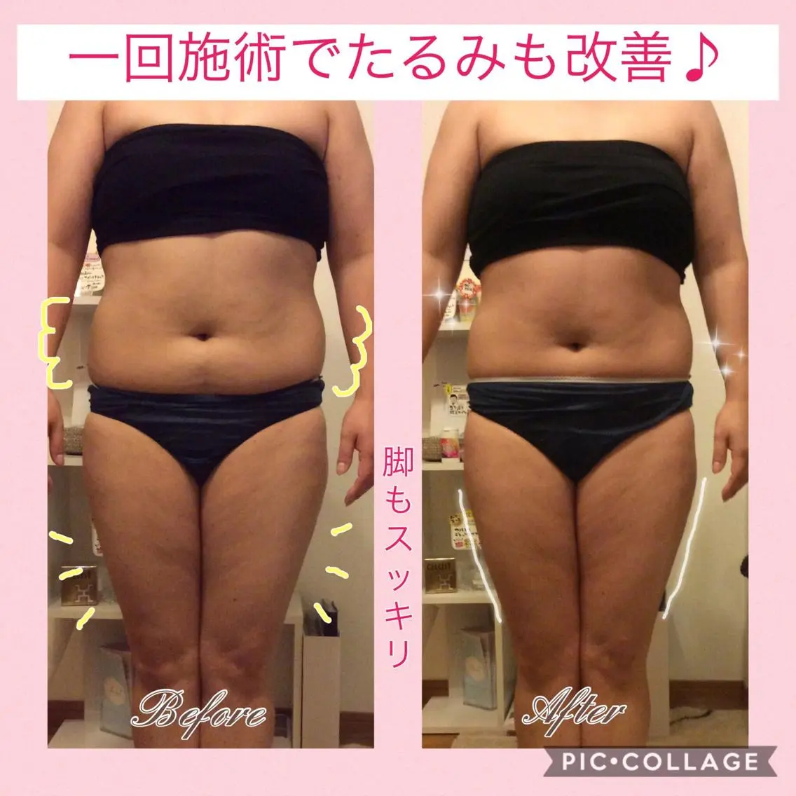 エステ リラク ダイエット・美肌ケア fleurのエステ・リラクイメージ