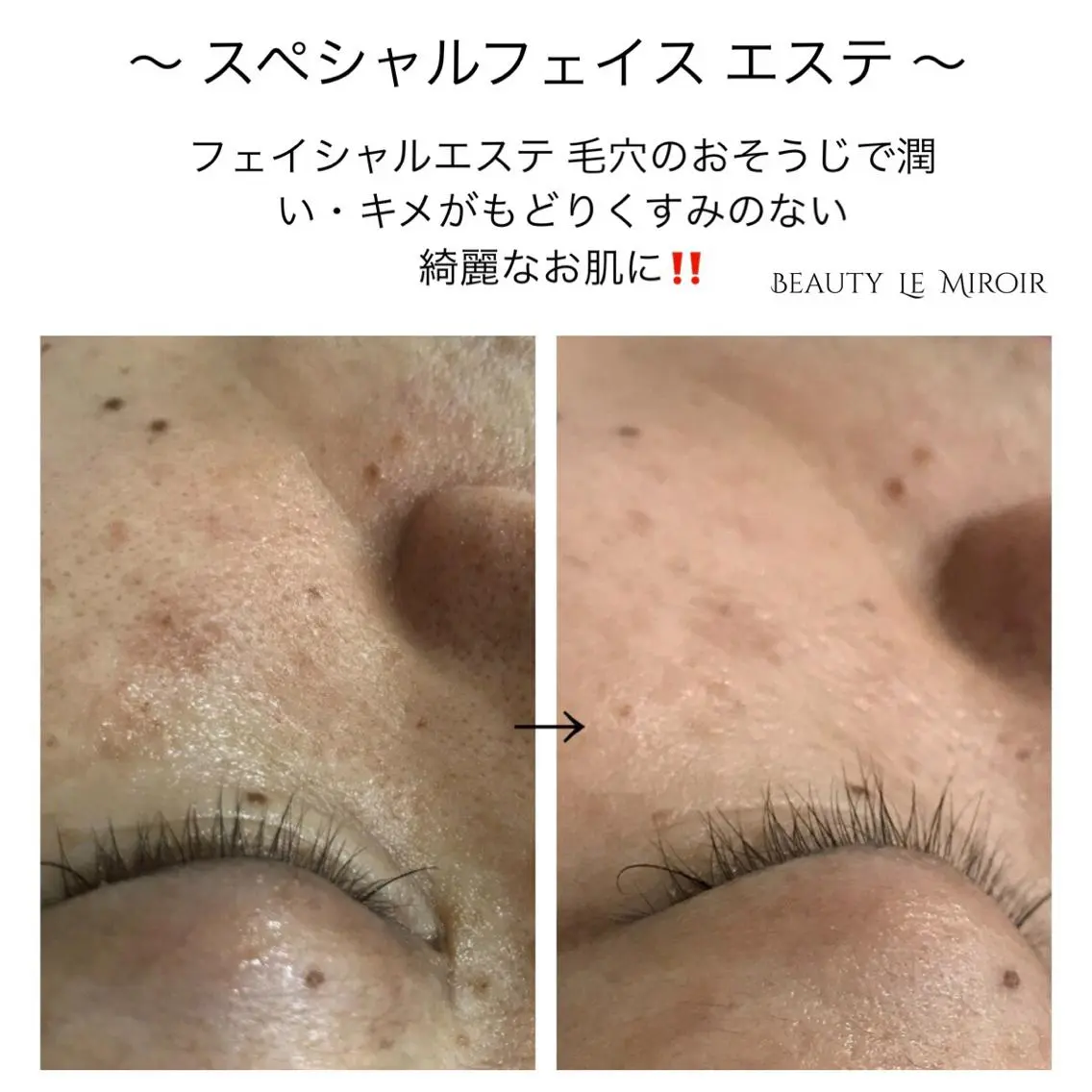 ビューティー ミロワールのエステ・リラクイメージ
