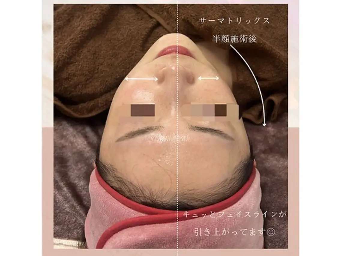看護師が施術する 美容サロン/元治のエステ・リラクイメージ