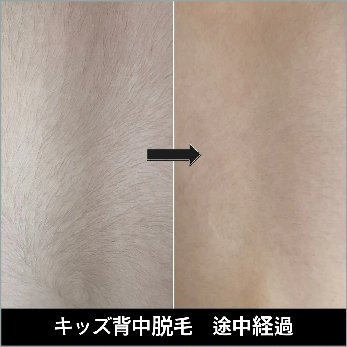 キッズ LUNARIA 〜ルナリア〜のエステ・リラクイメージ