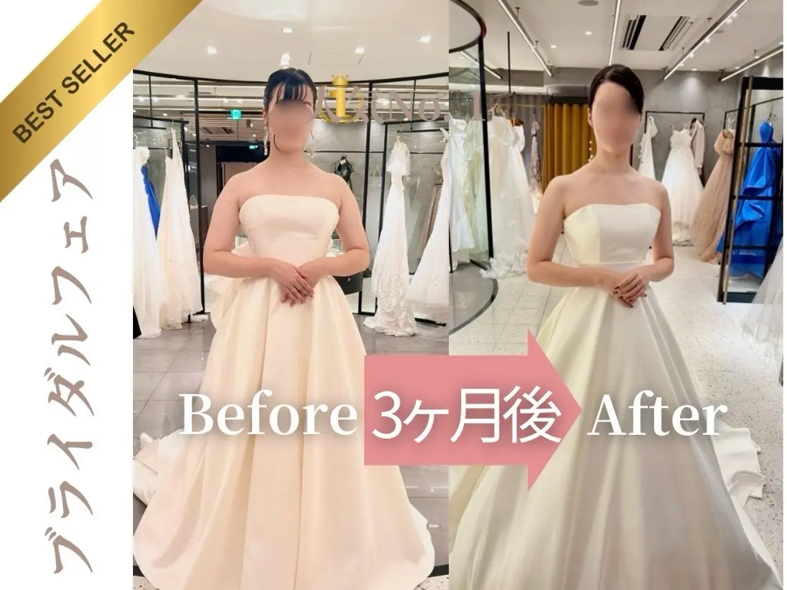 【花嫁人気】ドレスが映える背中・小顔・二の腕細見えケア初回体験90分¥5,480の写真