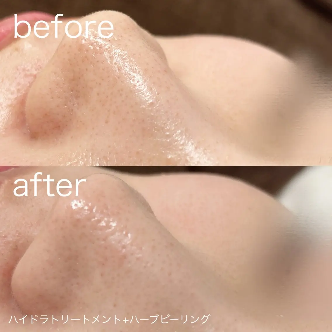 脱毛 lulularico Yuのネイルデザイン