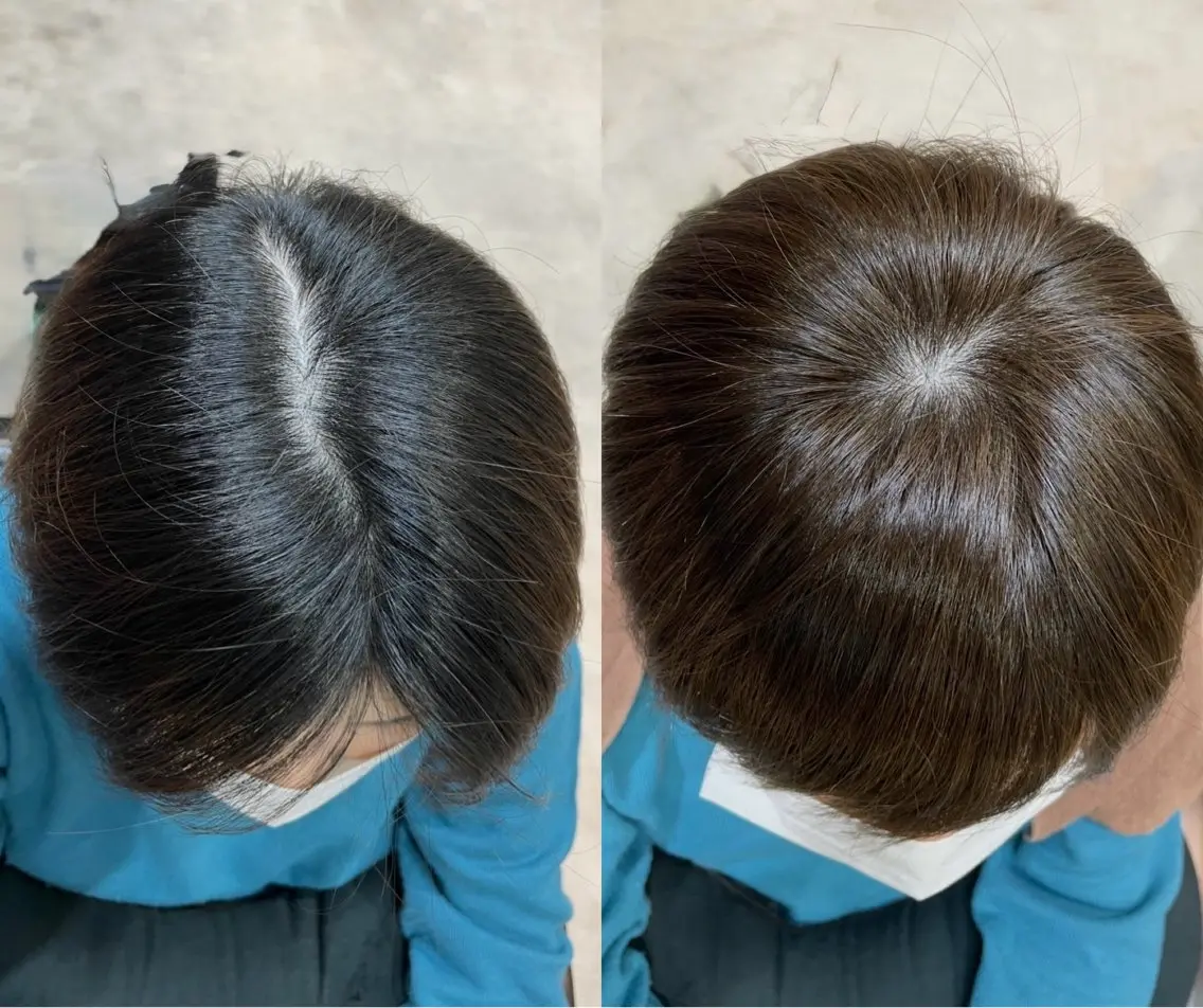 ショート 生えぐせ改善 黒木のヘアスタイル