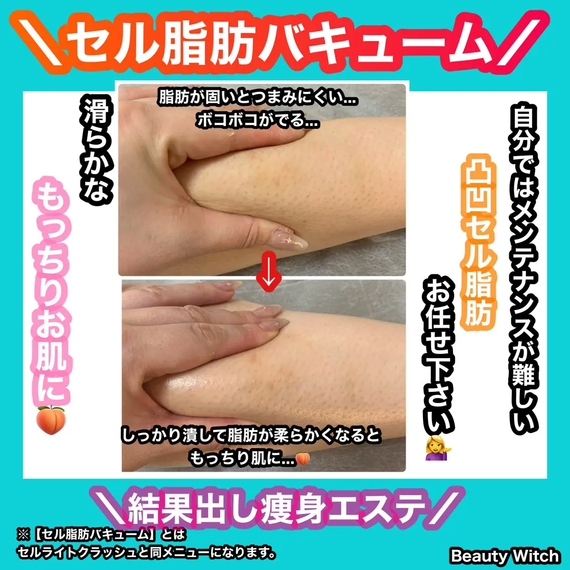 痩身/脱毛/ネイル HARUKAのエステ・リラクイメージ