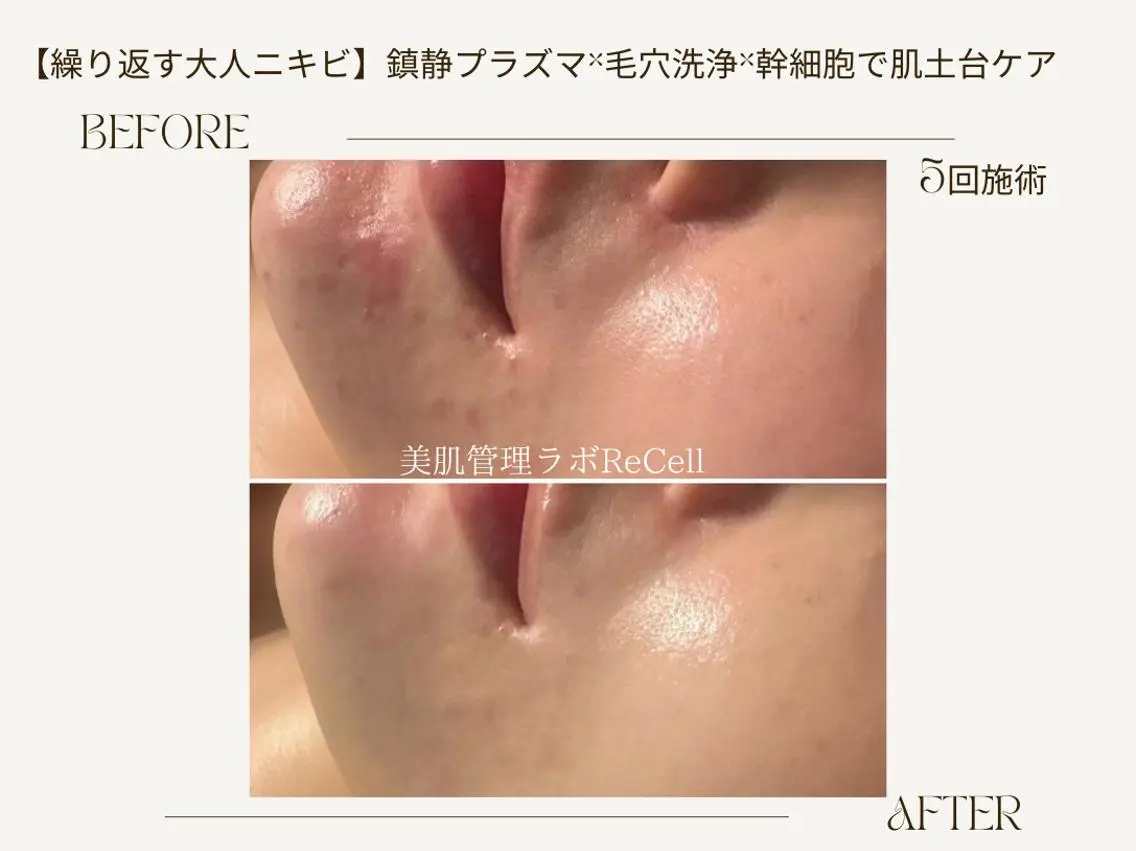 エステ ReCell 肌管理のエステ・リラクイメージ