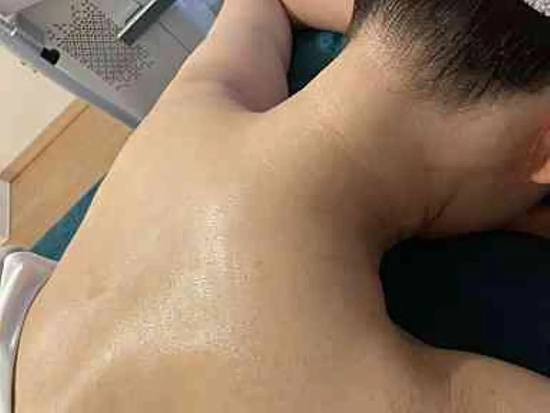 【この時期おススメ襟足脱毛】の写真