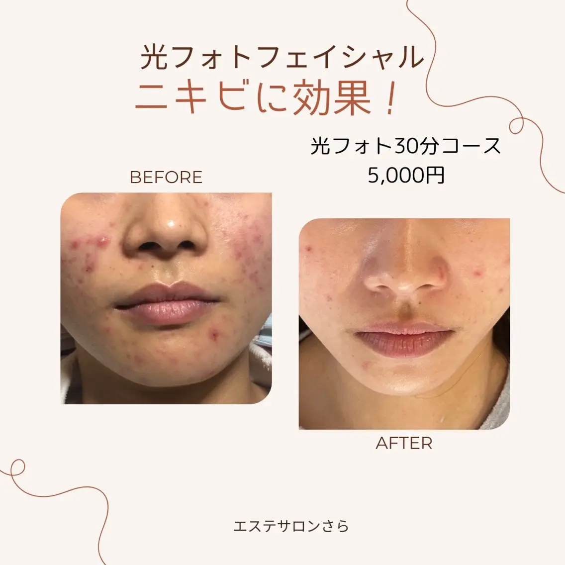 エステサロン さらのエステ・リラクイメージ