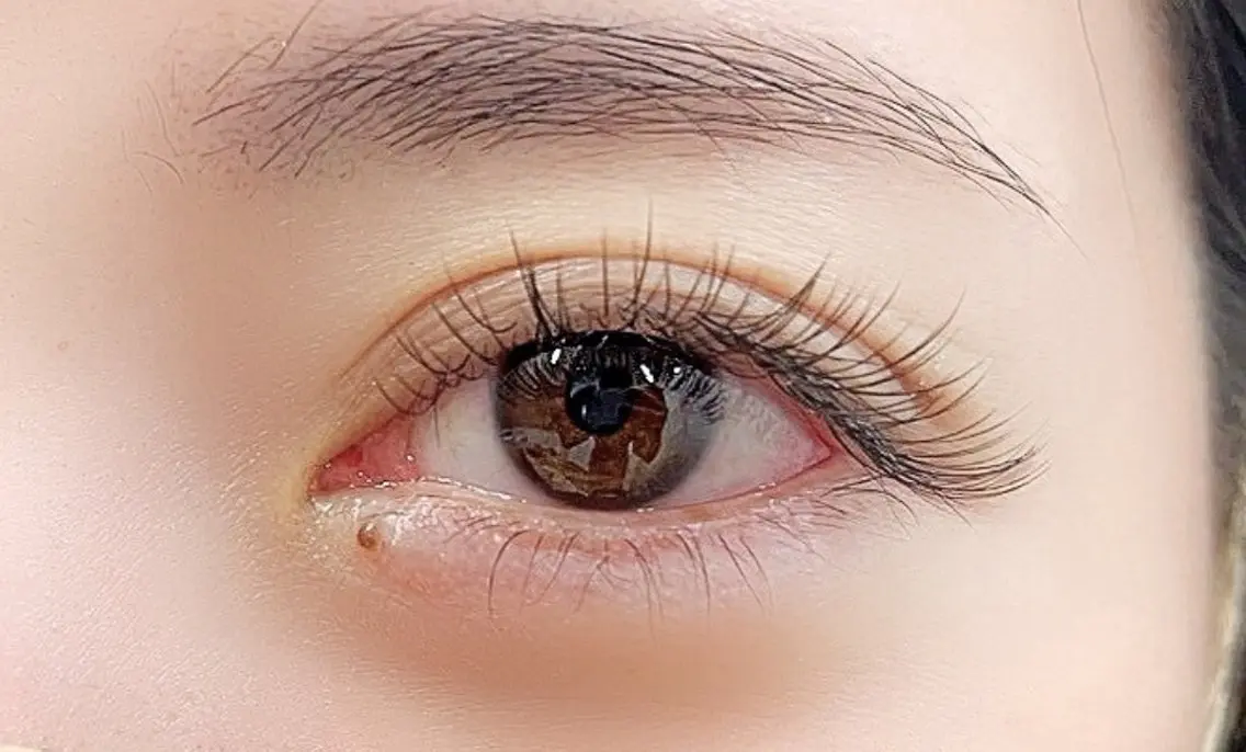 フラットラッシュ140本の写真
