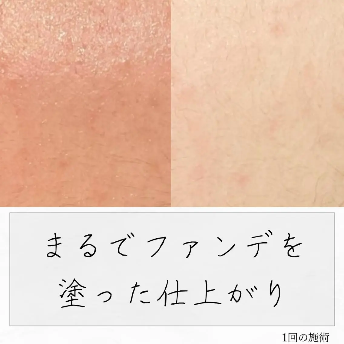 ニキビ経験者が施術 する専門サロン🌻のエステ・リラクイメージ