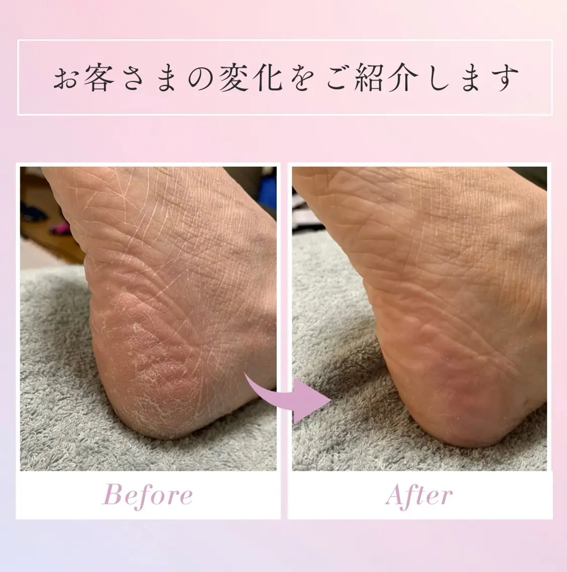 メンズ Nicolulu 金沢店のエステ・リラクイメージ