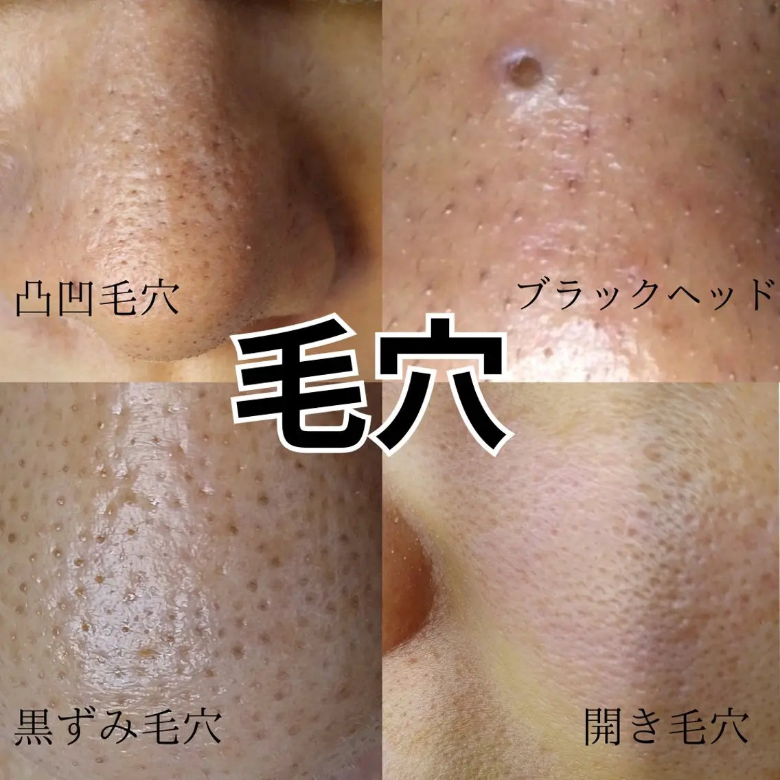 エステ 川口 春奈のエステ・リラクイメージ