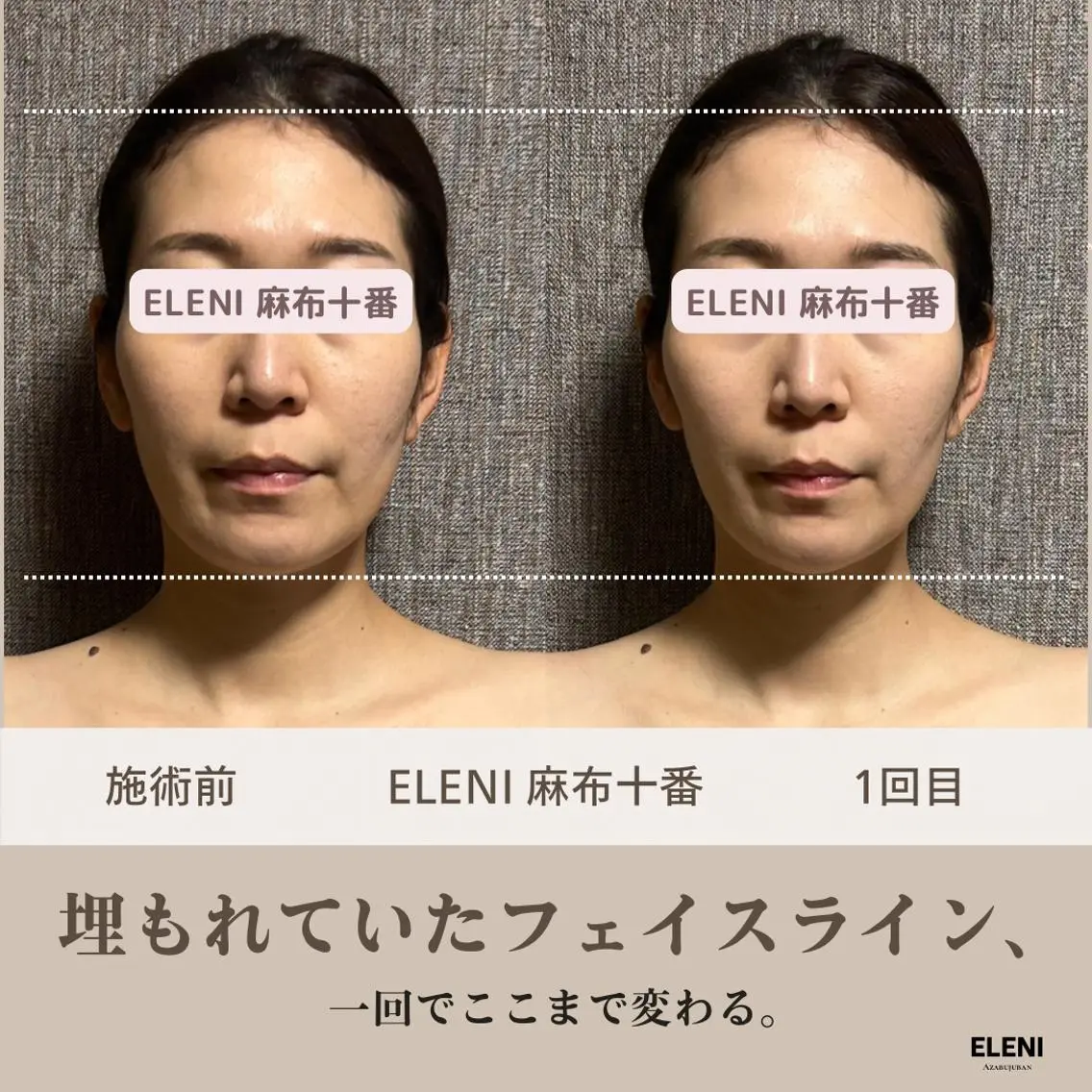 麻布十番小顔コルギ 姿勢矯正リアン💗のエステ・リラクイメージ